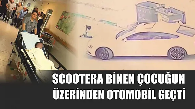 Scootera binen çocuğun üzerinden otomobil geçti