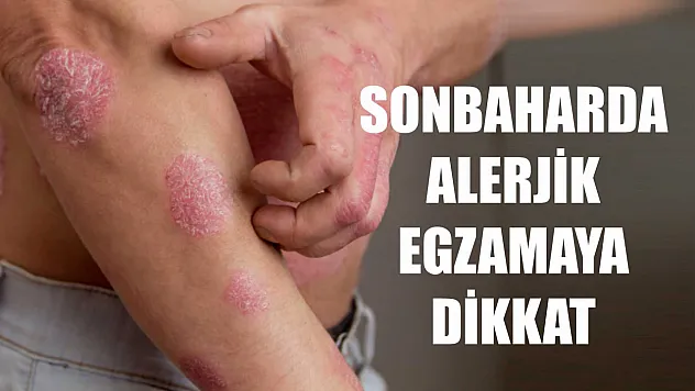 Sonbaharda alerjik egzamaya dikkat