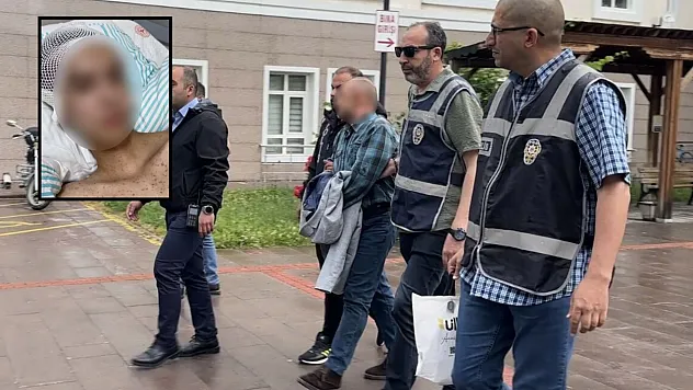 Tacize direndiği iddiasıyla başından vurulan çocuk felç kaldı