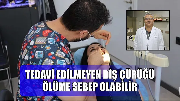 Tedavi edilmeyen diş çürüğü, ölüme sebep olabilir