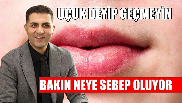Uçuk deyip geçmeyin, bakın neye sebep oluyor