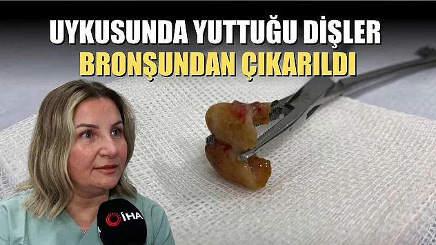 Uykusunda yuttuğu dişler bronşundan çıkarıldı