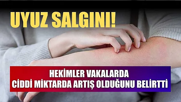 Uyuz salgını! Hekimler vakalarda ciddi miktarda artış olduğunu belirtti