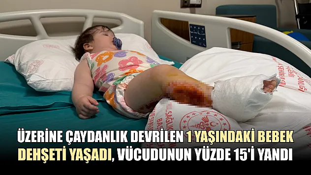 Üzerine çaydanlık devrilen 1 yaşındaki bebek dehşeti yaşadı, vücudunun yüzde 15'i yandı