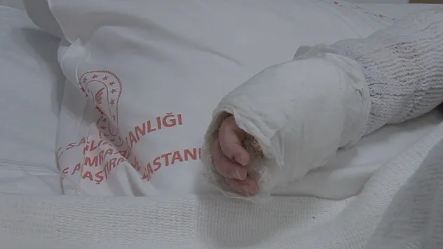 Üzerine kaynar su dökülen bebeğin vücudunun yüzde 27'si yandı