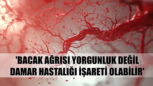 Uzmanı uyardı: 'Bacak ağrısı yorgunluk değil, damar hastalığı işareti olabilir'