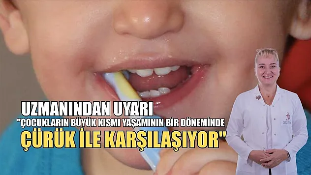 Uzmanından uyarı: 'Çocukların büyük kısmı yaşamının bir döneminde çürük ile karşılaşıyor'