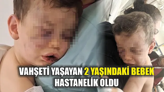 Vahşeti yaşayan 2 yaşındaki bebek hastanelik oldu