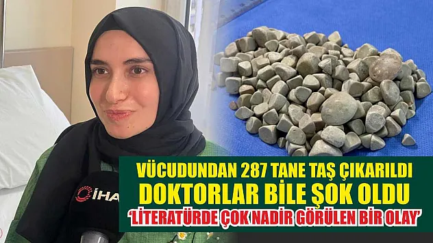 Vücudundan 287 tane taş çıkarıldı, doktorlar bile şok oldu: 'Literatürde çok nadir görülen bir olay'