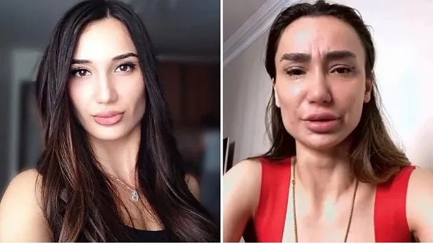 Yağmur Sarnıç neden intihar etti? Yağmur Sarnıç'ın sağlık durumu nasıl?