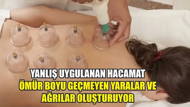 Yanlış uygulanan hacamat ömür boyu geçmeyen yaralar ve ağrılar oluşturuyor