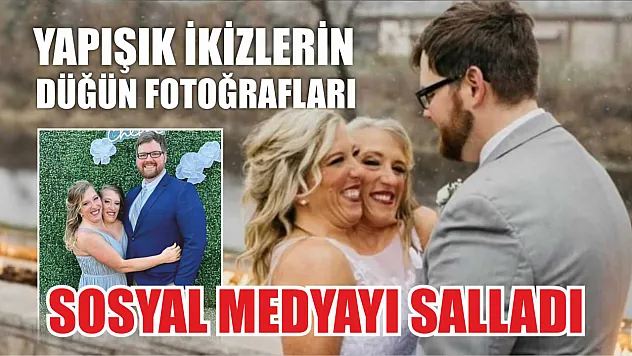 Yapışık ikizlerin düğün fotoğrafları sosyal medyayı salladı