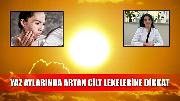 Yaz aylarında artan cilt lekelerine dikkat