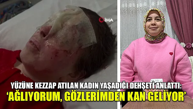 Yüzüne kezzap atılan kadın yaşadığı dehşeti anlattı: 'Ağlıyorum, gözlerimden kan geliyor'