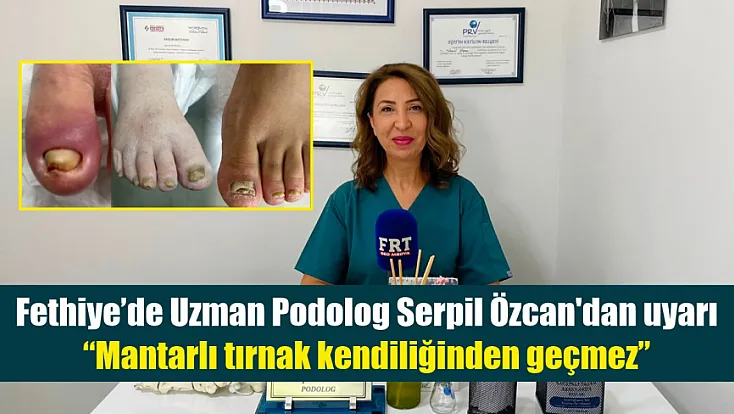 Fethiye’de Uzman Podolog Serpil Özcan'dan uyarı: ‘Mantarlı tırnak kendiliğinden geçmez’