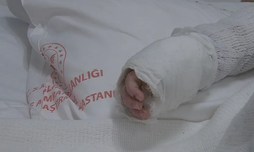 Üzerine kaynar su dökülen bebeğin vücudunun yüzde 27'si yandı